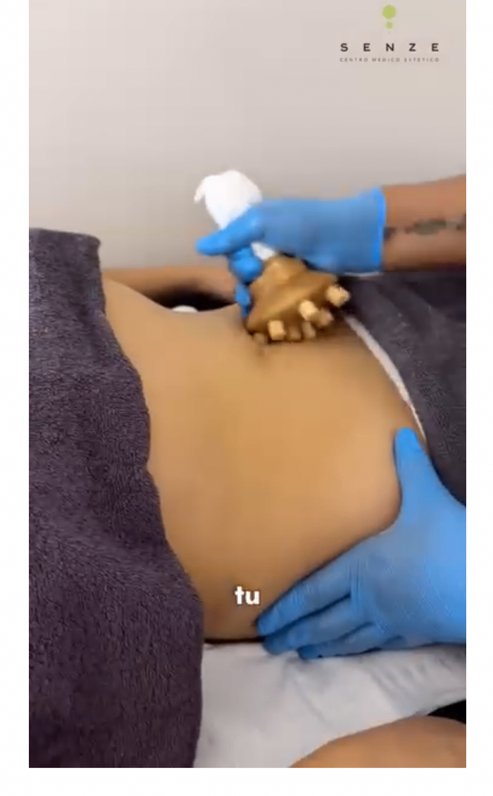 Maderoterapia en SENZE